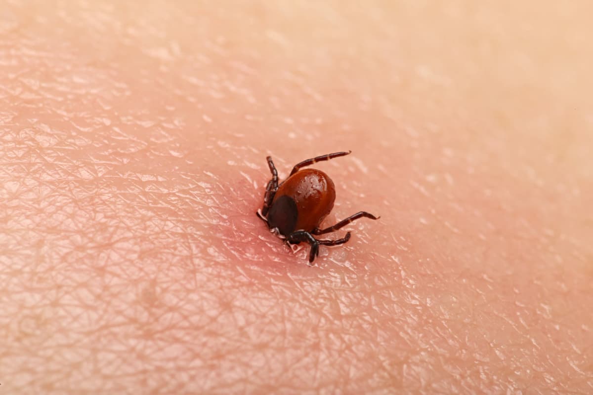 Guide détaillé pour la prévention de la maladie de Lyme
